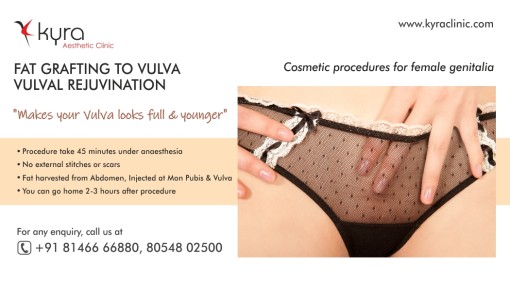 Fat Transfer to Vulva