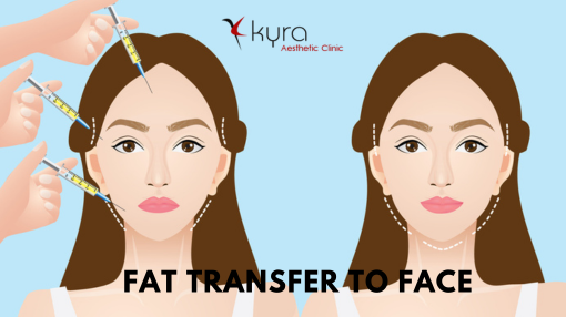 Fat Transfer to Face