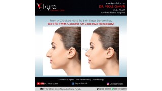 Rhinoplasty to get the aesthetic treatment 